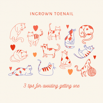 Ingrown Toenail – 3 Tips for Avoiding Getting One