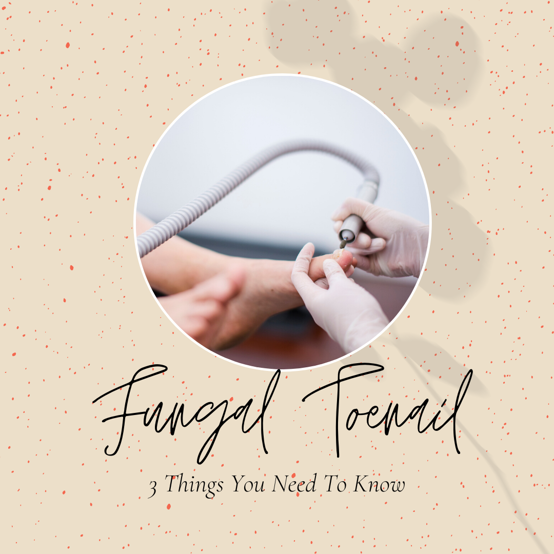 Fungal Toenail Infection: 3 Things You Need to Know